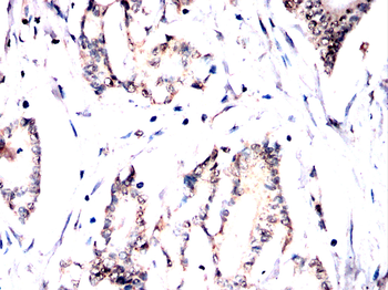 Cdkn2a Antibody