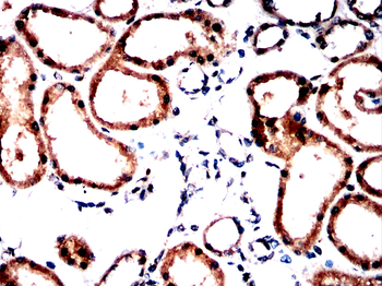 Cdkn2a Antibody