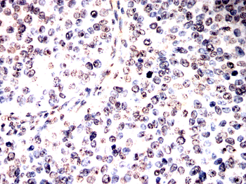 H2BC11 Antibody