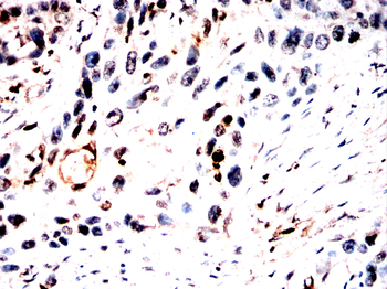 H2BC11 Antibody