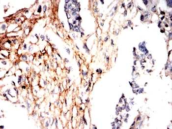 THBS1 Antibody
