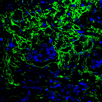 THBS1 Antibody