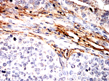 THBS1 Antibody