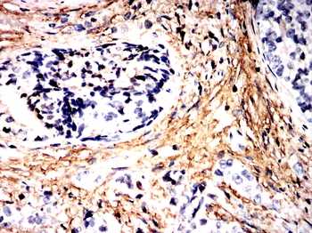 THBS1 Antibody