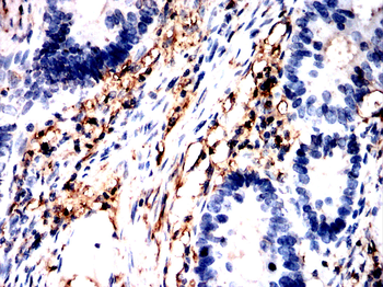 THBS1 Antibody