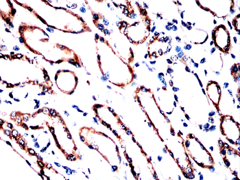 MAOB Antibody