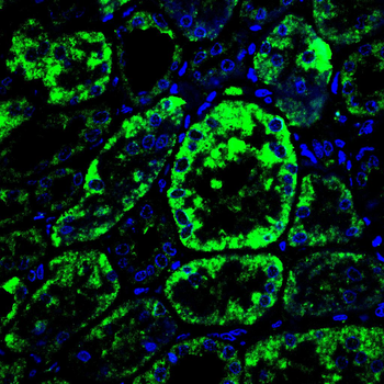 MAOB Antibody
