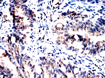 MAOB Antibody