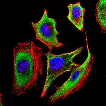 MAOB Antibody