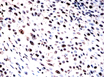 NUP85 Antibody