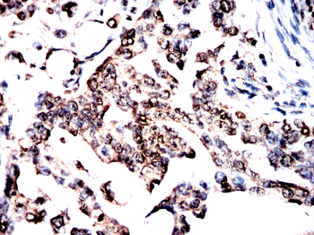 NUP85 Antibody