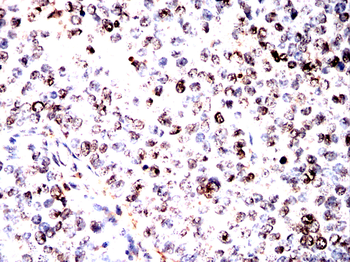 NUP85 Antibody