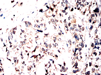 NUP85 Antibody
