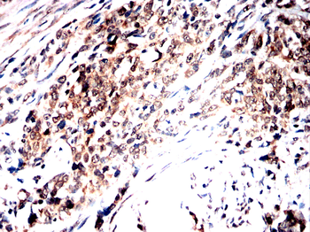 NUP85 Antibody