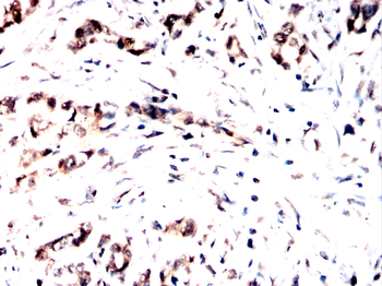 NUP85 Antibody