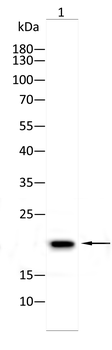 PTGDS Antibody