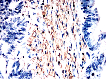 ACTB Antibody