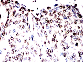 HSP90AA1 Antibody