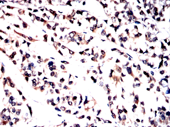 TYK2 Antibody