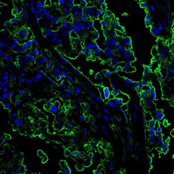 TYK2 Antibody