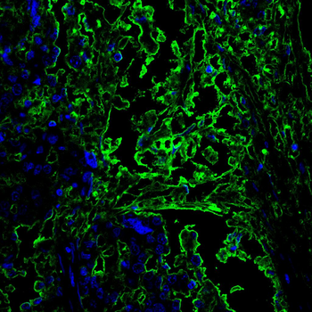 TYK2 Antibody