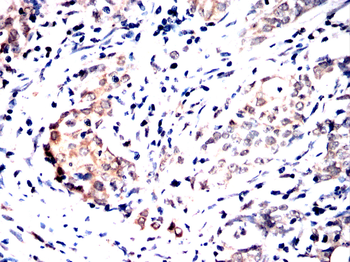 TYK2 Antibody