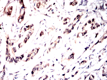TYK2 Antibody