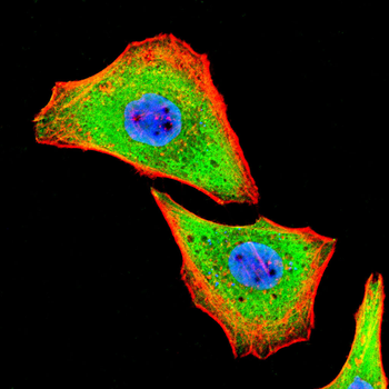 TYK2 Antibody