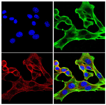 ADCY3 Antibody