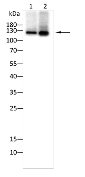 ADCY3 Antibody