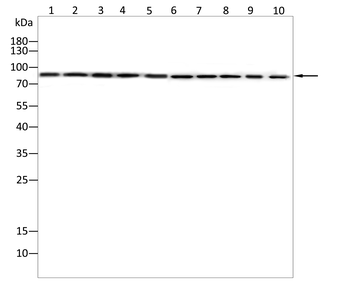 ADCY3 Antibody