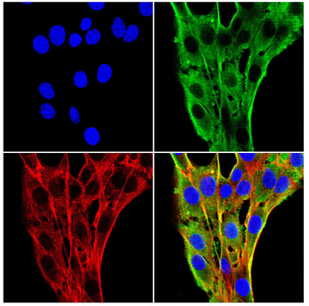 IFNGR1 Antibody