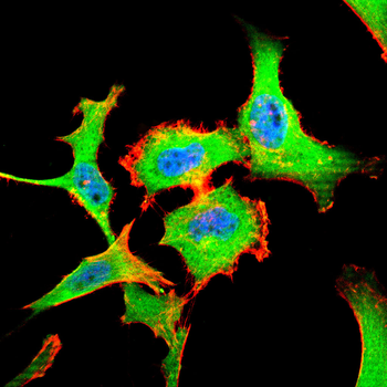 IFNGR1 Antibody