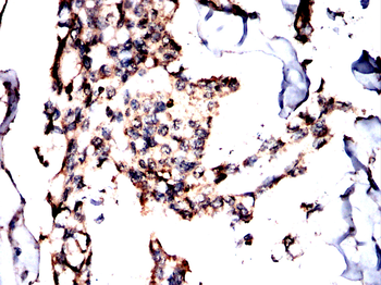 BAX Antibody