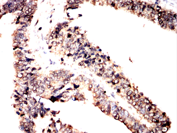 BAX Antibody