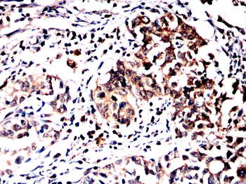 SYK Antibody