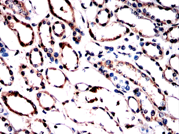 SYK Antibody