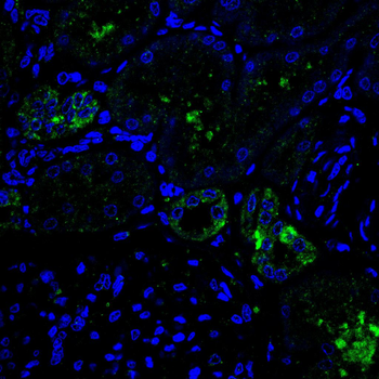 SYK Antibody