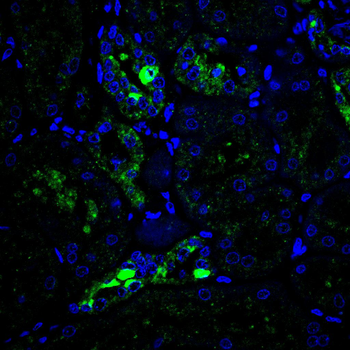 SYK Antibody