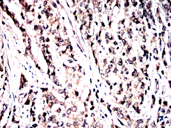 SYK Antibody