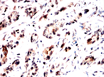 SYK Antibody