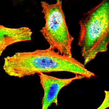 ACACA Antibody