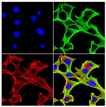 SLC6A1 Antibody