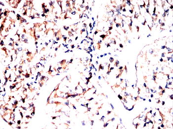 SLC6A1 Antibody