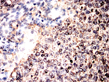 STX17 Antibody