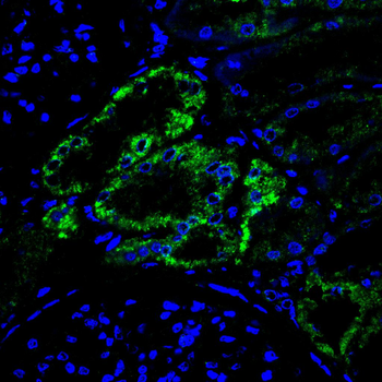 STX17 Antibody