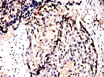 STX17 Antibody