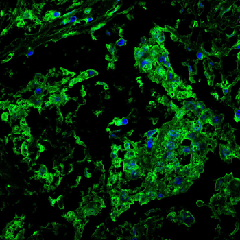PAK2 Antibody