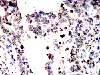 PAK2 Antibody