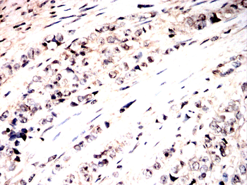 PAK2 Antibody